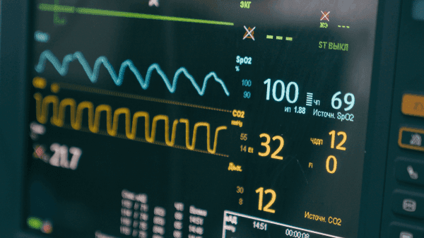 Heart rate monitor iRhythm